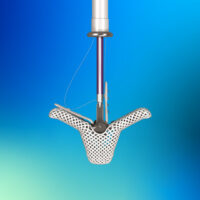 TriClip: la nueva alternativa para pacientes que no podían operarse del corazón implantado por primera vez en San Juan